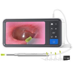 FondCircle MS45039 Digital Otoscope with 4.5" Screen - Ear Wax Removal Kit